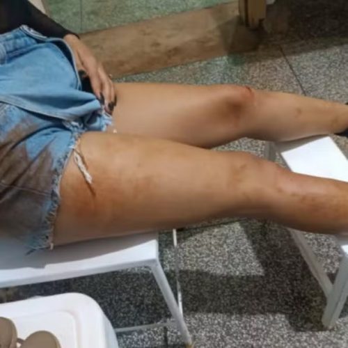 Polícia detém adolescente que espancou esposa de 17 anos