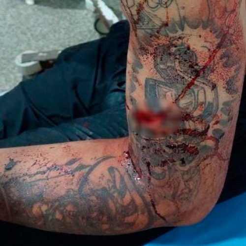Jovem é atacado a facadas por negar romance em festa de Porto Velho