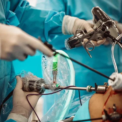 Novas regras ampliam recomendações para cirurgia bariátrica; veja
