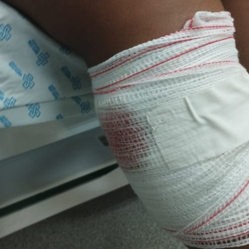 Jovem é baleada enquanto segurava bebê no colo em Candeias do Jamari