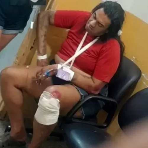 Criador do ‘Candeias Reality’ sofre acidente e passará por cirurgia após fraturas graves
